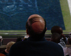 combover1 Going bald?...Take it off!